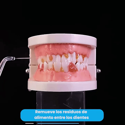 ✨ AquaSmile Pro – Irrigador Dental Inalámbrico ✨