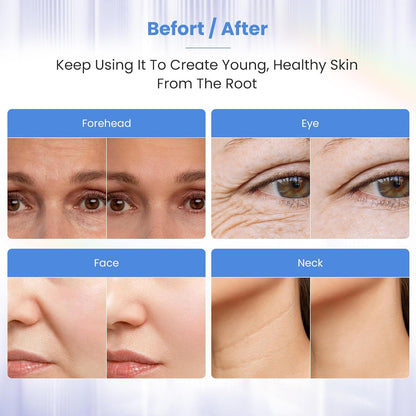 Masajeador Facial de Microcorriente - NuGlow