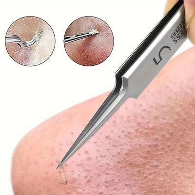 Kit Extractor de Espinillas - ClearSkin