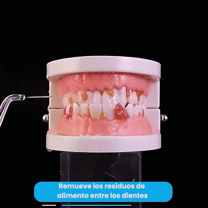 ✨ AquaSmile Pro – Irrigador Dental Inalámbrico ✨