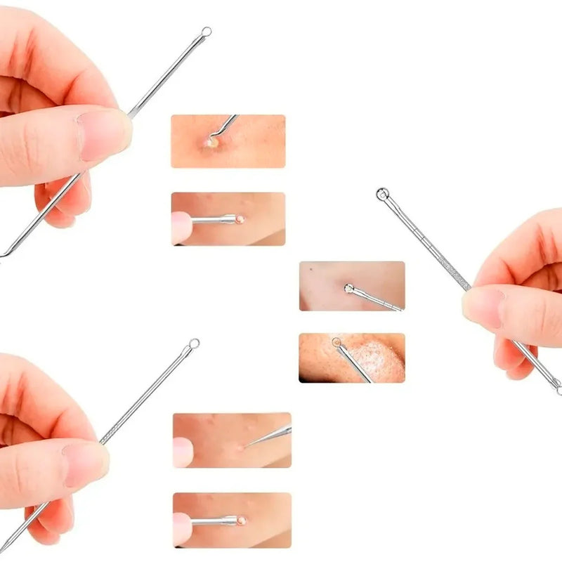 Kit Extractor de Espinillas - ClearSkin